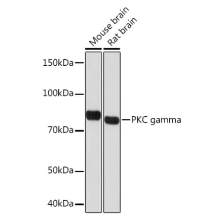 Western Blot - Anti-PKC gamma Antibody [ARC1637] (A305980) - Antibodies.com