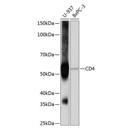 Western Blot - Anti-CD4 Antibody [ARC0328] (A305983) - Antibodies.com