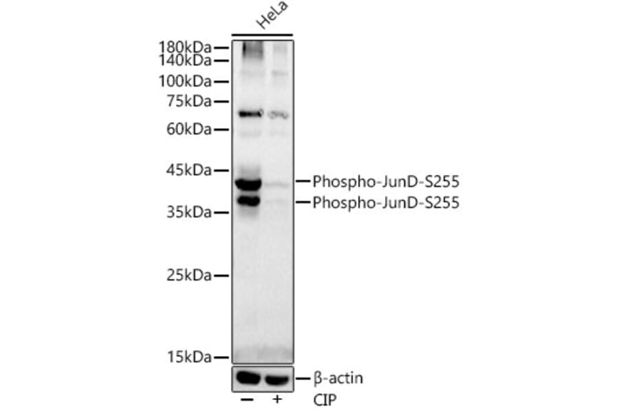 Western Blot - Anti-JunD (phospho Ser255) Antibody [ARC54895] (A305984) - Antibodies.com