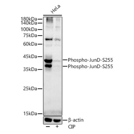 Western Blot - Anti-JunD (phospho Ser255) Antibody [ARC54895] (A305984) - Antibodies.com