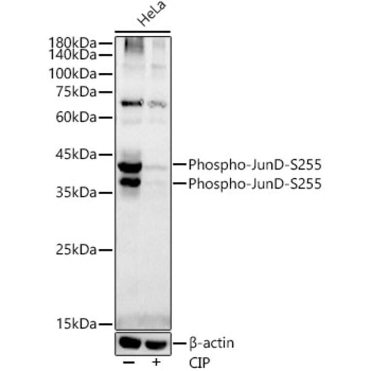 Western Blot - Anti-JunD (phospho Ser255) Antibody [ARC54895] (A305984) - Antibodies.com