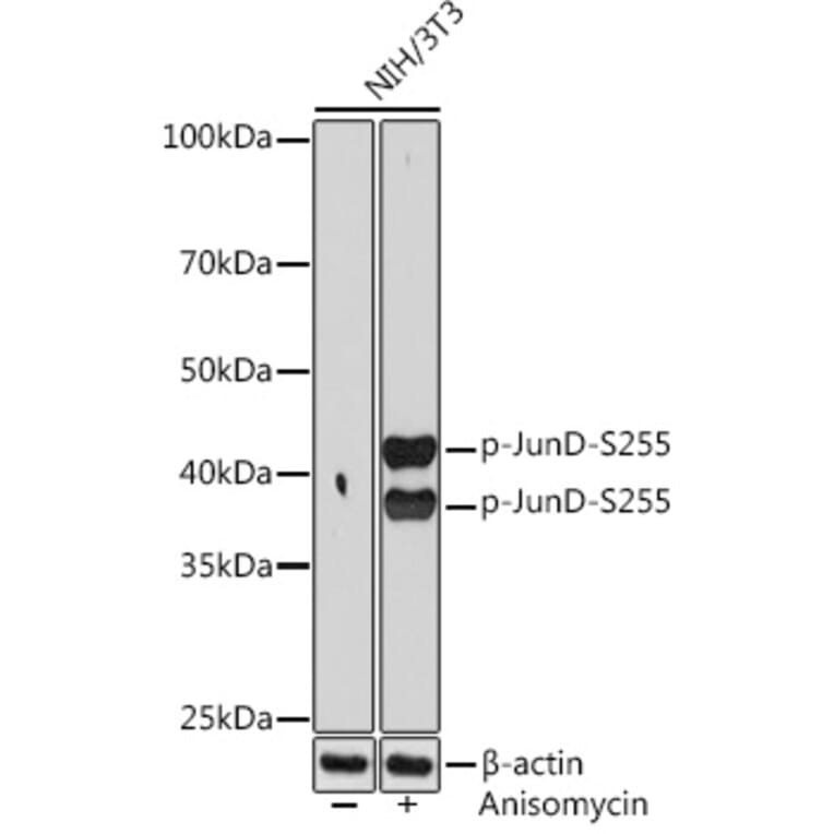 Western Blot - Anti-JunD (phospho Ser255) Antibody [ARC1603] (A305985) - Antibodies.com