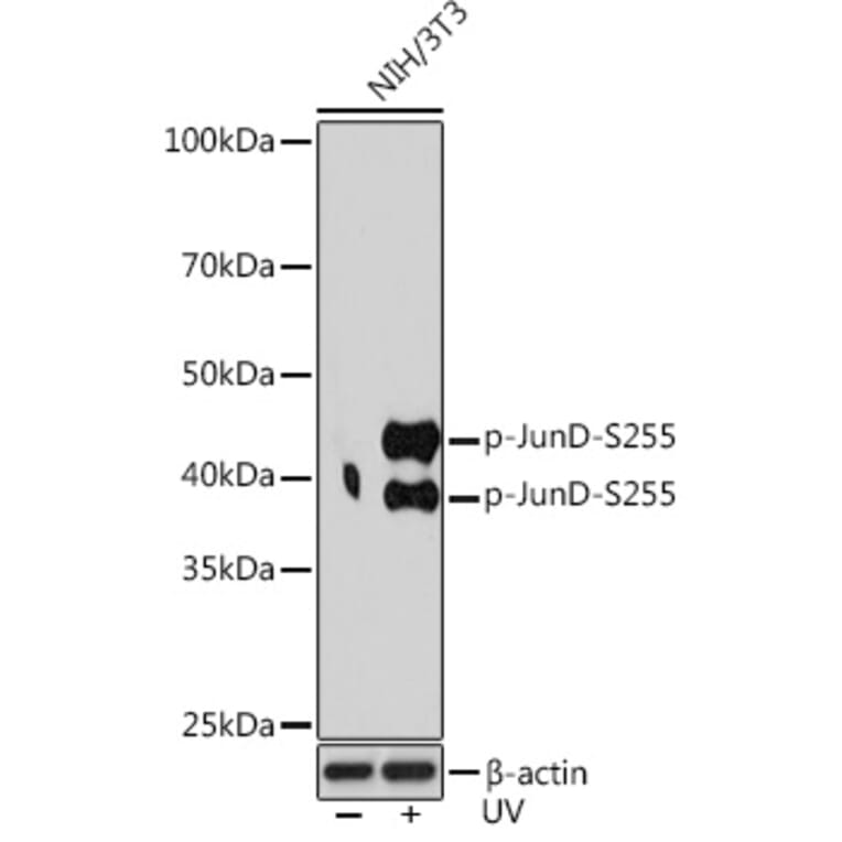 Western Blot - Anti-JunD (phospho Ser255) Antibody [ARC1603] (A305985) - Antibodies.com