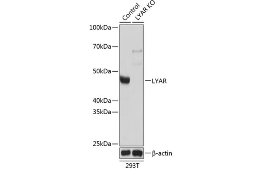 Western Blot - Anti-LYAR Antibody (A305987) - Antibodies.com