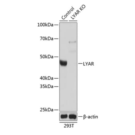 Western Blot - Anti-LYAR Antibody (A305987) - Antibodies.com
