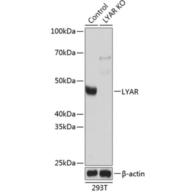 Western Blot - Anti-LYAR Antibody (A305987) - Antibodies.com