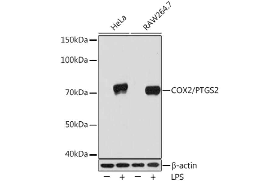 Western Blot - Anti-COX2 Antibody [ARC0800] (A305988) - Antibodies.com