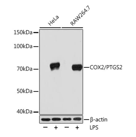 Western Blot - Anti-COX2 Antibody [ARC0800] (A305988) - Antibodies.com