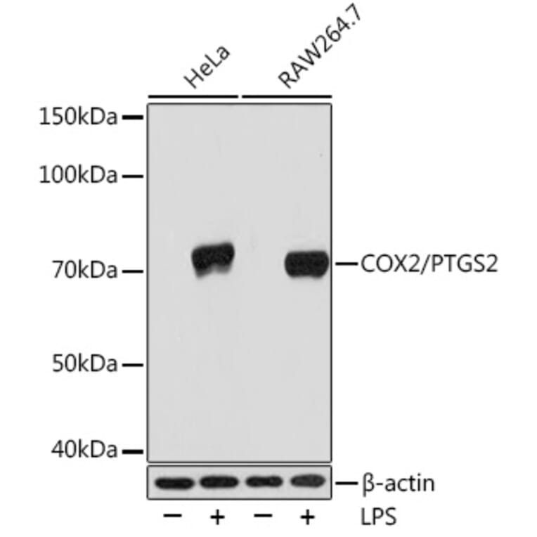 Western Blot - Anti-COX2 Antibody [ARC0800] (A305988) - Antibodies.com