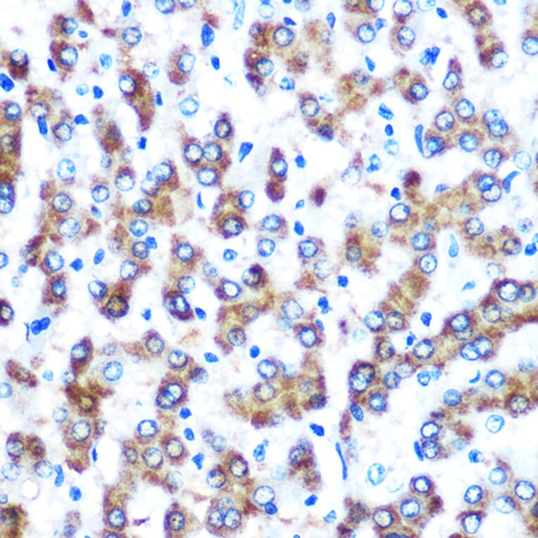 Immunohistochemistry - Anti-COX2 Antibody [ARC0800] (A305988) - Antibodies.com