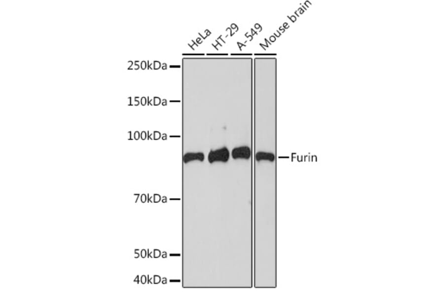 Western Blot - Anti-Furin Antibody [ARC1221] (A305990) - Antibodies.com