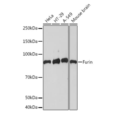 Western Blot - Anti-Furin Antibody [ARC1221] (A305990) - Antibodies.com