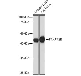 Western Blot - Anti-PRKAR2B Antibody [ARC2272] (A305991) - Antibodies.com