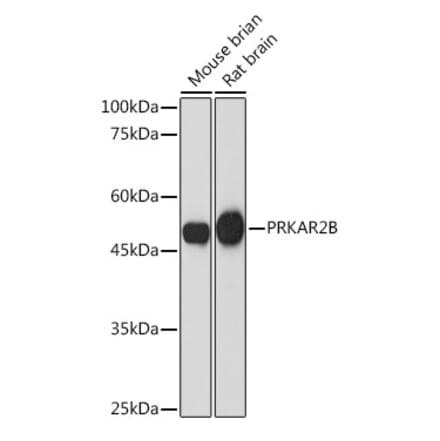 Western Blot - Anti-PRKAR2B Antibody [ARC2272] (A305991) - Antibodies.com