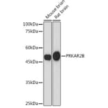 Western Blot - Anti-PRKAR2B Antibody [ARC2272] (A305991) - Antibodies.com