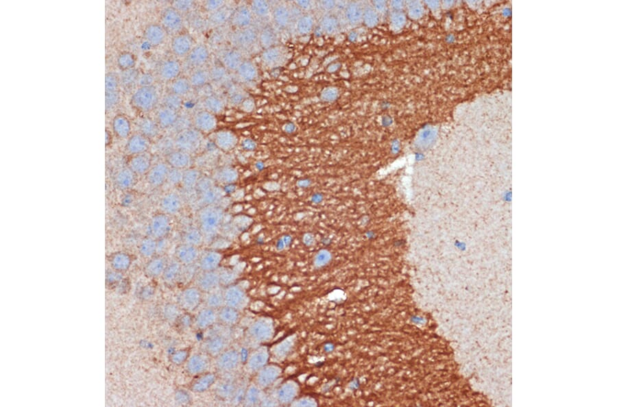 Immunohistochemistry - Anti-PRKAR2B Antibody [ARC2272] (A305991) - Antibodies.com