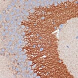 Immunohistochemistry - Anti-PRKAR2B Antibody [ARC2272] (A305991) - Antibodies.com