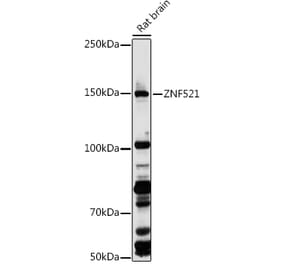 Western Blot - Anti-ZNF521 Antibody (A305992) - Antibodies.com