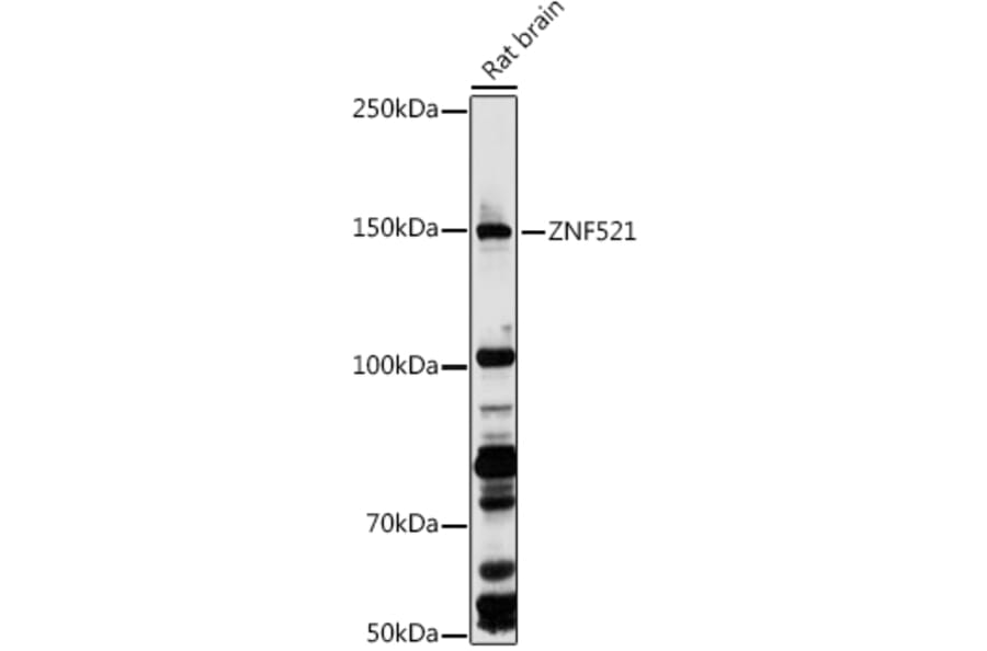 Western Blot - Anti-ZNF521 Antibody (A305992) - Antibodies.com