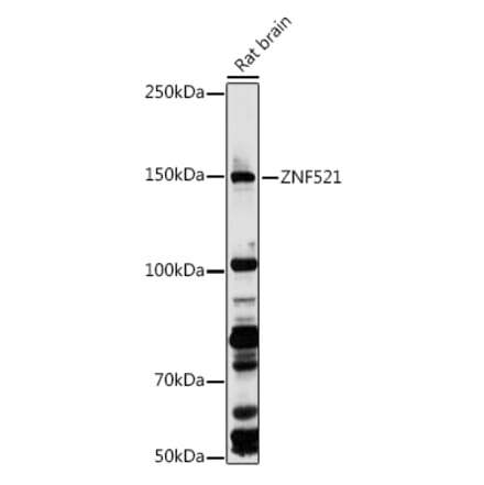 Western Blot - Anti-ZNF521 Antibody (A305992) - Antibodies.com