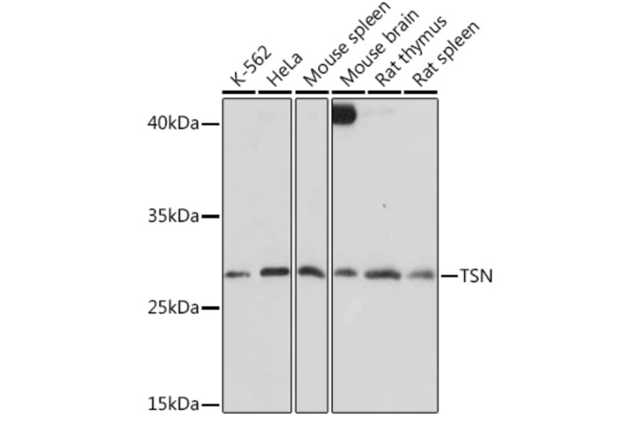 Western Blot - Anti-Translin/TSN Antibody (A305994) - Antibodies.com