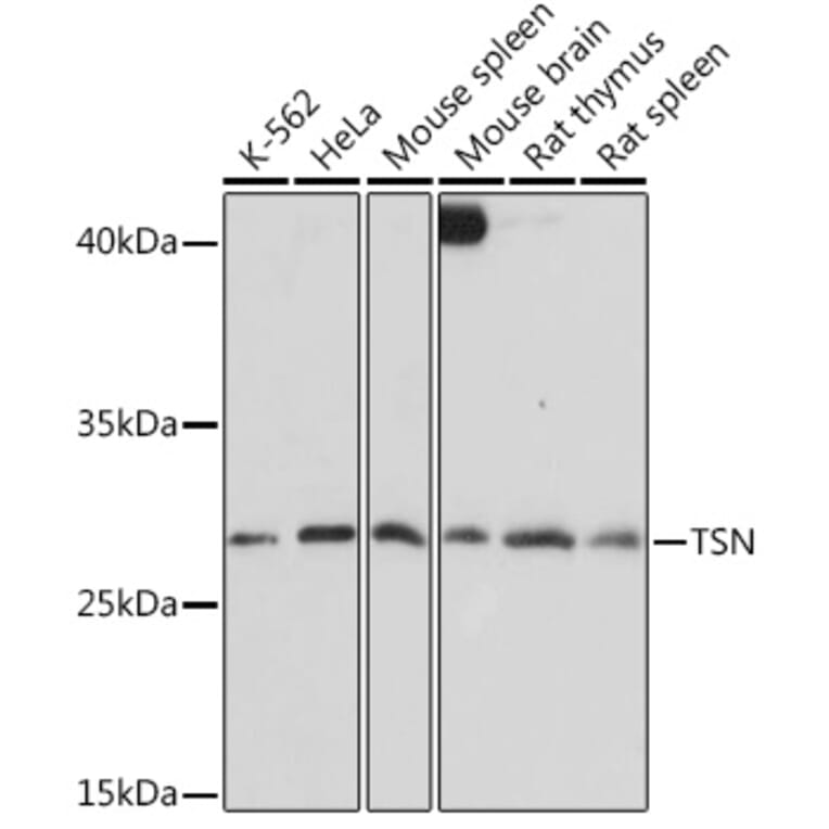 Western Blot - Anti-Translin/TSN Antibody (A305994) - Antibodies.com