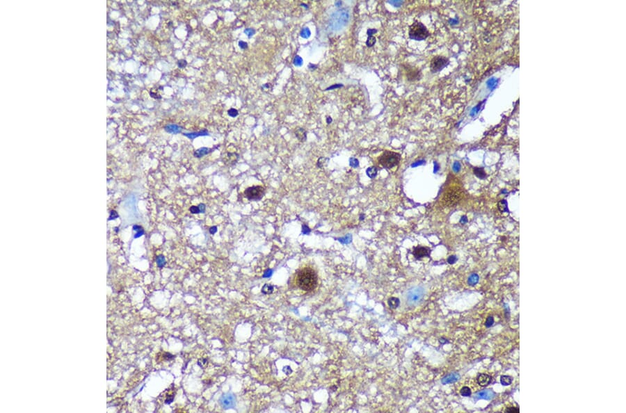 Immunohistochemistry - Anti-Translin/TSN Antibody (A305994) - Antibodies.com