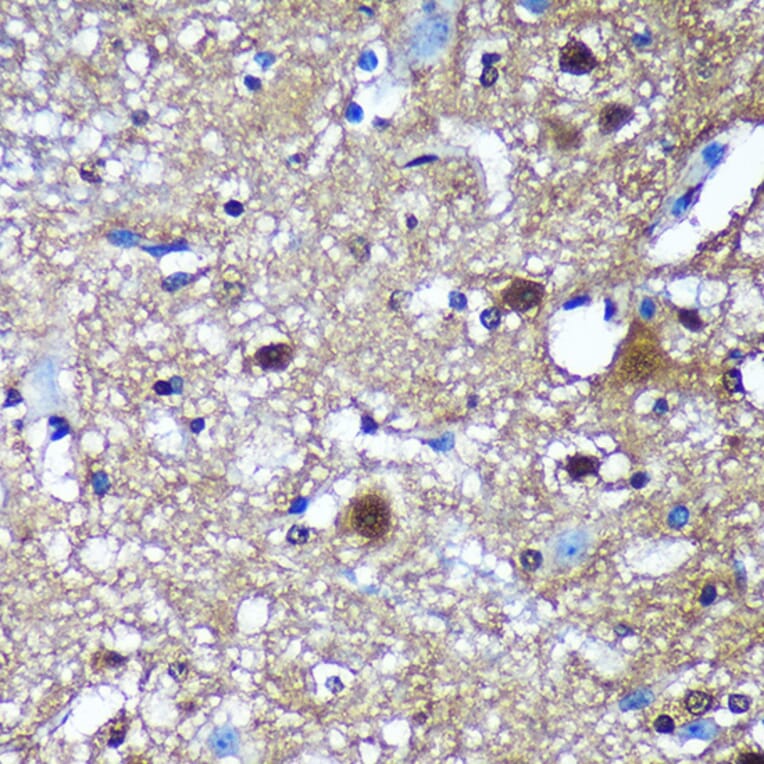 Immunohistochemistry - Anti-Translin/TSN Antibody (A305994) - Antibodies.com