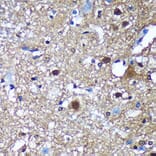 Immunohistochemistry - Anti-Translin/TSN Antibody (A305994) - Antibodies.com