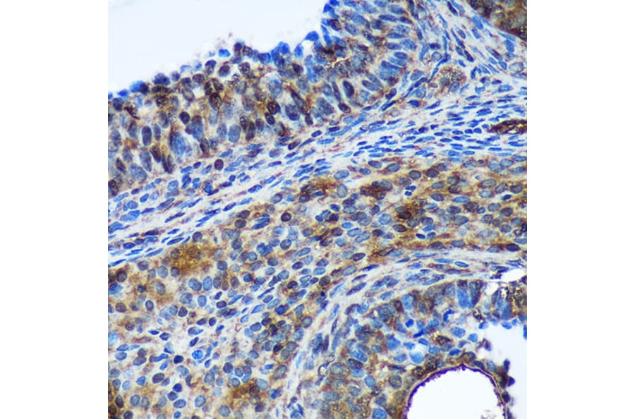 Immunohistochemistry - Anti-Translin/TSN Antibody (A305994) - Antibodies.com