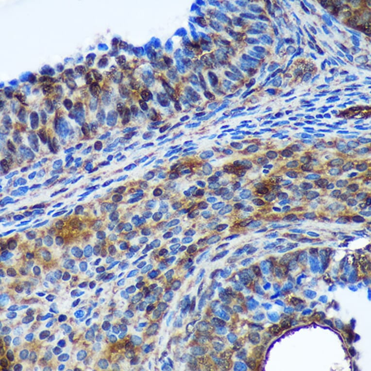 Immunohistochemistry - Anti-Translin/TSN Antibody (A305994) - Antibodies.com