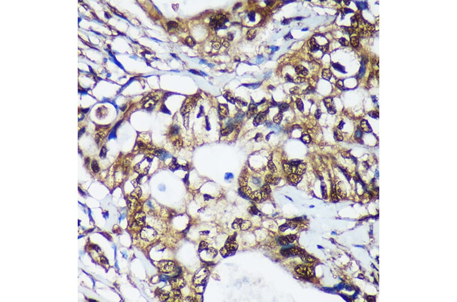 Immunohistochemistry - Anti-Translin/TSN Antibody (A305994) - Antibodies.com