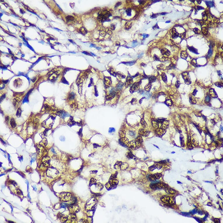 Immunohistochemistry - Anti-Translin/TSN Antibody (A305994) - Antibodies.com