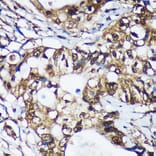 Immunohistochemistry - Anti-Translin/TSN Antibody (A305994) - Antibodies.com