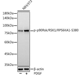 Western Blot - Anti-RSK1 p90 (phospho Ser380) Antibody [ARC1608] (A305996) - Antibodies.com