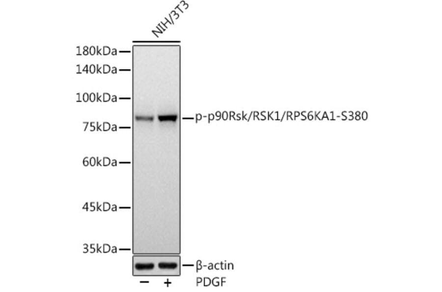 Western Blot - Anti-RSK1 p90 (phospho Ser380) Antibody [ARC1608] (A305996) - Antibodies.com