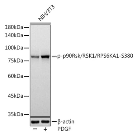 Western Blot - Anti-RSK1 p90 (phospho Ser380) Antibody [ARC1608] (A305996) - Antibodies.com