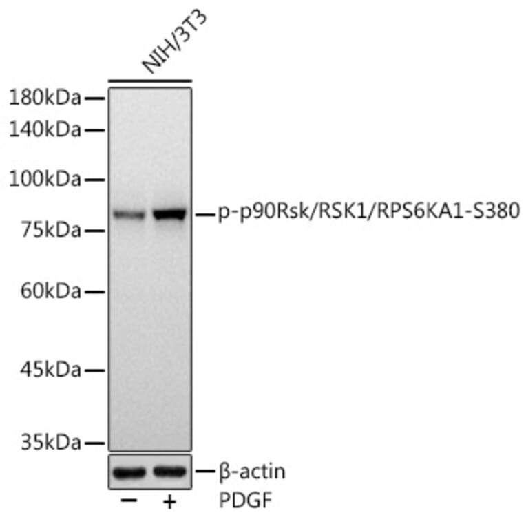 Western Blot - Anti-RSK1 p90 (phospho Ser380) Antibody [ARC1608] (A305996) - Antibodies.com