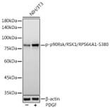 Western Blot - Anti-RSK1 p90 (phospho Ser380) Antibody [ARC1608] (A305996) - Antibodies.com