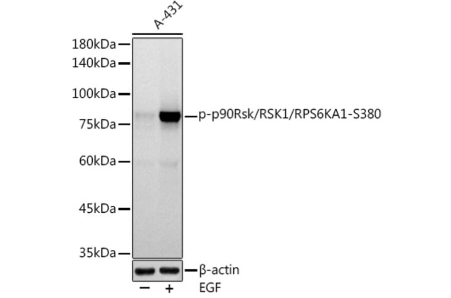 Western Blot - Anti-RSK1 p90 (phospho Ser380) Antibody [ARC1608] (A305996) - Antibodies.com