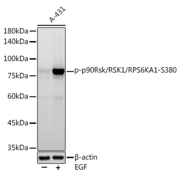 Western Blot - Anti-RSK1 p90 (phospho Ser380) Antibody [ARC1608] (A305996) - Antibodies.com