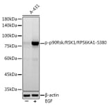 Western Blot - Anti-RSK1 p90 (phospho Ser380) Antibody [ARC1608] (A305996) - Antibodies.com