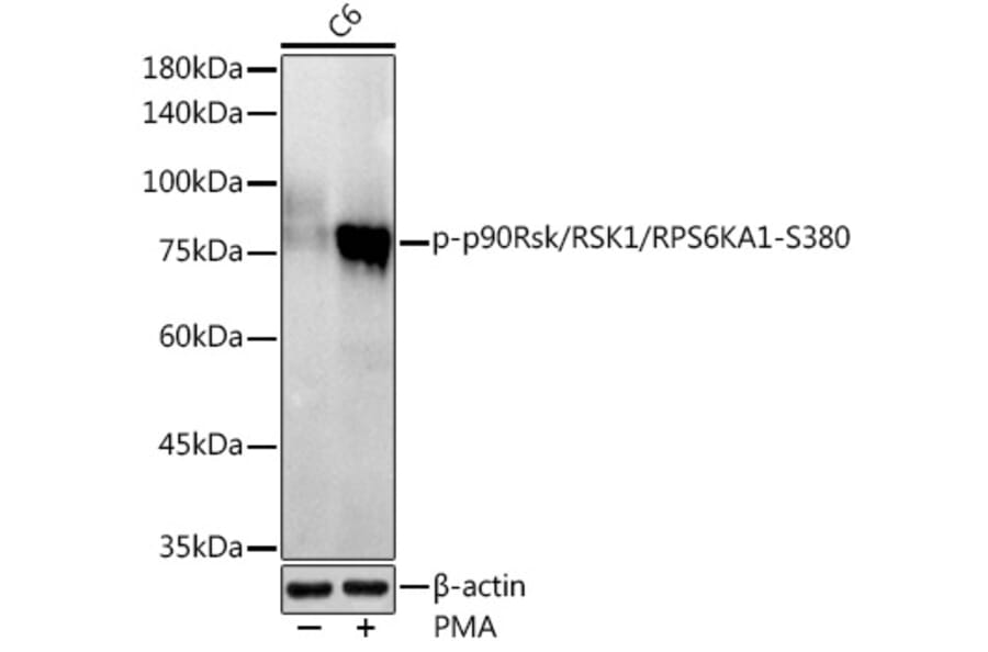 Western Blot - Anti-RSK1 p90 (phospho Ser380) Antibody [ARC1608] (A305996) - Antibodies.com