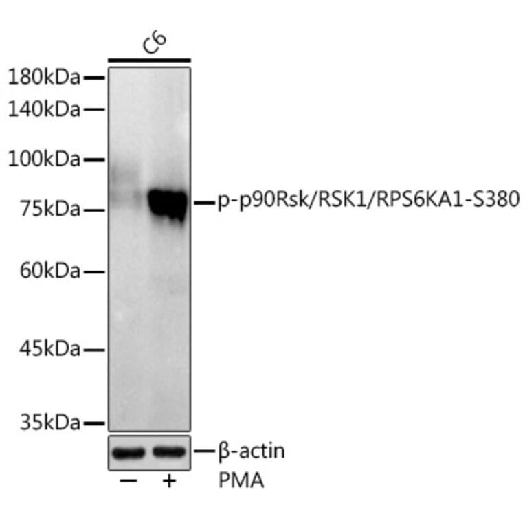 Western Blot - Anti-RSK1 p90 (phospho Ser380) Antibody [ARC1608] (A305996) - Antibodies.com