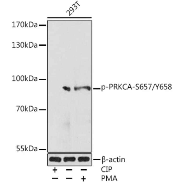 Western Blot - Anti-PKC alpha (phospho Ser657 + Tyr658) Antibody (A305997) - Antibodies.com