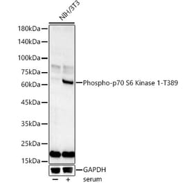 Western Blot - Anti-S6K1 (phospho Thr389) Antibody (A305998) - Antibodies.com