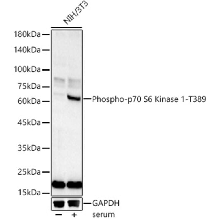Western Blot - Anti-S6K1 (phospho Thr389) Antibody (A305998) - Antibodies.com