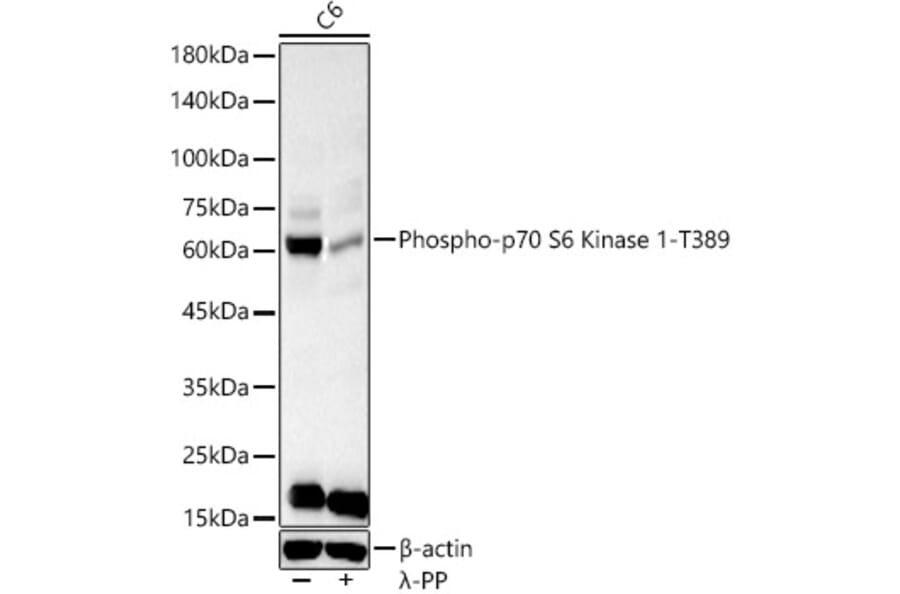 Western Blot - Anti-S6K1 (phospho Thr389) Antibody (A305998) - Antibodies.com
