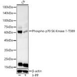 Western Blot - Anti-S6K1 (phospho Thr389) Antibody (A305998) - Antibodies.com