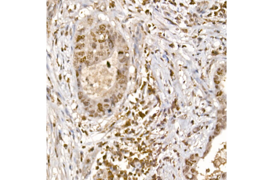 Immunohistochemistry - Anti-S6K1 (phospho Thr389) Antibody (A305998) - Antibodies.com